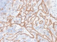 Formalin-fixed, paraffin embedded human tonsil sections stained with 100 ul anti-Beta Catenin (clone CTNNB1/2030R) at 1:400. HIER epitope retrieval prior to staining was performed in 10mM Citrate, pH 6.0.